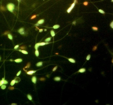 Vitalidad
de espermatozoides analizados con Vital test ® EPZ vivos
de color verde y muertos de color rojo (magnificacion 400X)