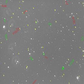 Mobility of spermatozoa loaded with 1.5 mg cyclodextrin (MCD) classified
according to their trajectory (red, green and blue) and static (yellow).
