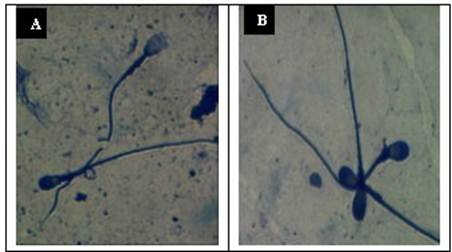Acrosomal
integrity with Coomasie blue staining. (A) EPZ with acrosome loss and (B)
intact EPZ acrosome