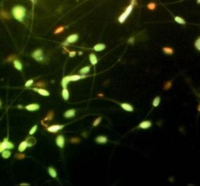 Vitality of spermatozoa
analyzed with Vital test® EPZ live in green and dead in red (400X
magnification)