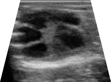 Ultrasonograf&iacute;a de ovario de llama con presencia de varios fol&iacute;culos (reclutamiento folicular)