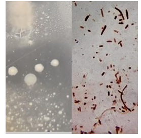 Cepas productoras de
inhibición sobre otros microorganismos. a: halos de inhibición en agar del
crecimiento de cepa de EM. b: tinción de gram de las colonias que presentaban
halos de inhibición.