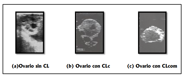 Im&aacute;genes
ecogr&aacute;ficas de ovarios (a): ovario sin cuerpo l&uacute;teo, (b): ovario con CLc, (c): ovario con
CLcom.
