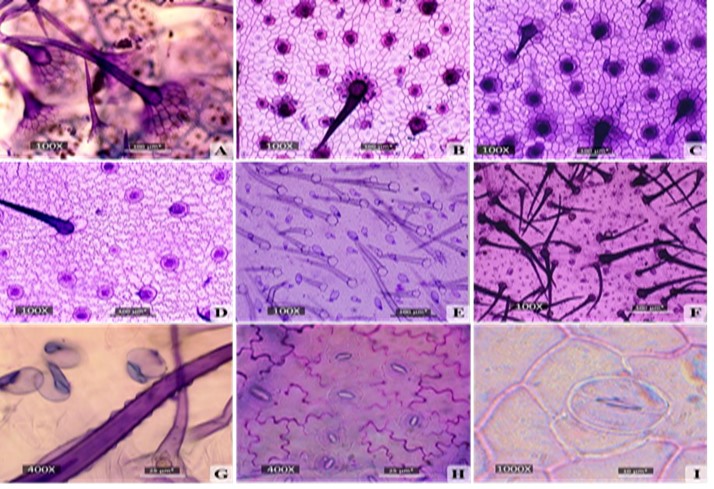 Vista superficial de la lámina foliar de las
especies de Varronia. A) Epidermis adaxial de V. bullata. B)
Epidermis adaxial de V. inermis (población de Alanje). C) Epidermis
adaxial de V. inermis (población de Alanje). D) Epidermis adaxial de V.
inermis (población de Río Guanábano). E) Tricomas simples y glandulares en
la epidermis abaxial de V. inermis. F) Tricomas simples y glandulares en
la epidermis abaxial de V. linnaei. G) Papilas en los tricomas simples
de V. bullata. H) Estomas en la epidermis abaxial de V. inermis.
I) Estomas en la epidermis abaxial de V. linnaei