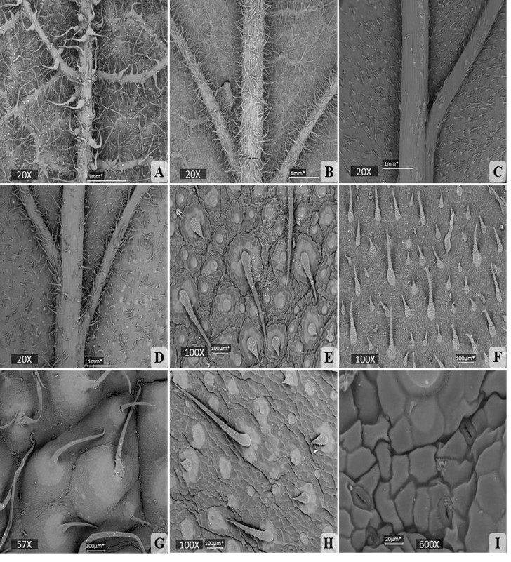 Microfotografías tomadas con el MEB de la
lámina foliar de las especies de Varronia. A) Epidermis abaxial de V.
bullata. B) Epidermis abaxial de V. linnaei. C) Epidermis abaxial de
V. inermis (población Río Guanábano). D) Epidermis abaxial de V.
inermis (población Limones). E) Epidermis adaxial de V. inermis
(población Río Guanábano). F) Epidermis adaxial de V. linnaei. G)
Epidermis adaxial de V. bullata. H) Epidermis adaxial de V. inermis
(población Limones). I) Estomas en la epidermis adaxial de V. inermis
(población Limones)