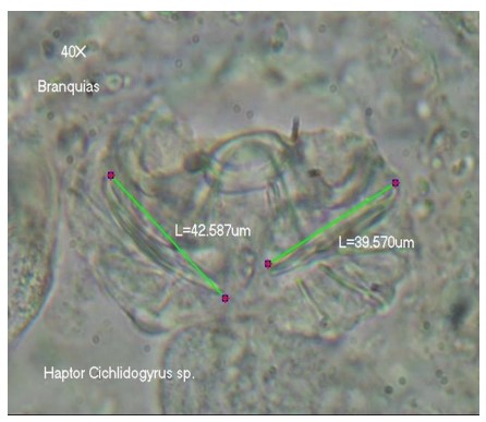 Haptor
de Ciclhidogyrus sp. destacando la medida de sus macroganchos.