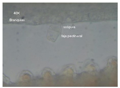  Ambiphrya sp. observado en muestra fresca de branquias. 