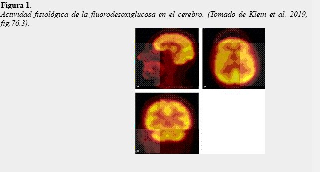 Actividad fisiológica de la fluorodesoxiglucosa en el cerebro