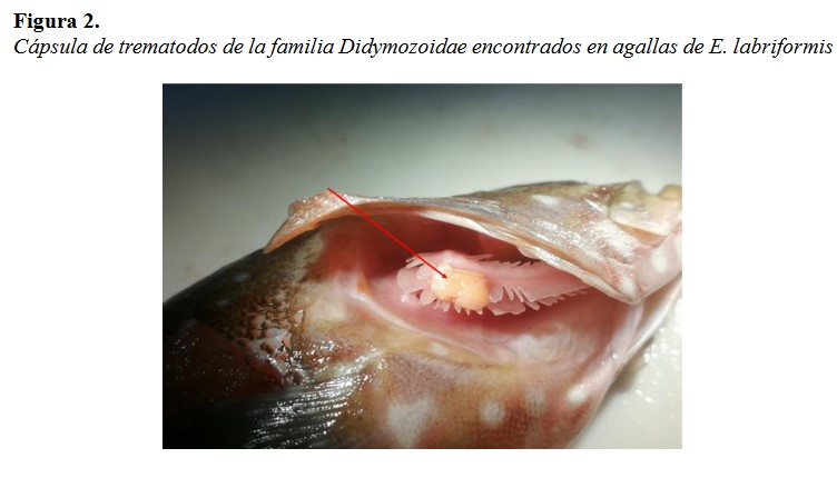 Cápsula de trematodos de la familia Didymozoidae encontrados en agallas de E. labriformis
