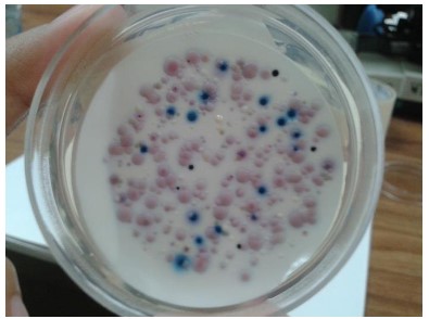 Conteo de
colonias en agar Chromogenic coliforms