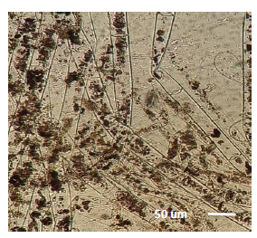 Esporangióforos no identificados presente en las muestras de agua. Microscopía
óptica 10x.

 