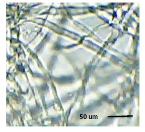 Algas en el agua. Se observan los pigmentos fotosintéticos. Microscopía óptica
40x.