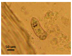 Monogeneo juvenil, familia Gyrodactylidae encontrado en
superficie corporal. Microscopía óptica 40x.