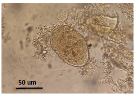 Quiste de Myxosporidios encontrados en intestino. Microscopía óptica 40x.