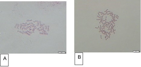 A) Cromosomas de A. satureioides, 2 n= 30. B) Cromosomas of A.
     satureioides var. Lamarce-INTA, 4 n= 60. Barr = 5 µ.
