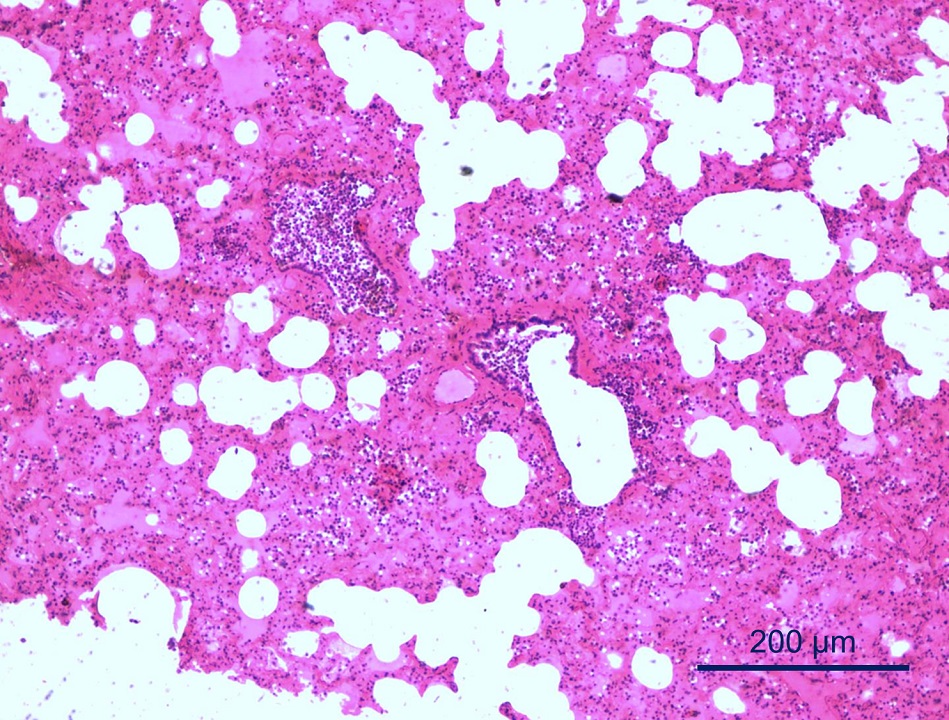 Necropsia N1