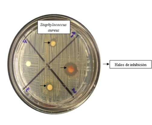 Poder inhibitorio de extractos vegetales sobre el Staphylococcus aureus.