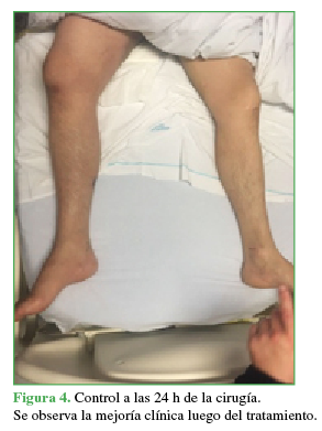 Control a las 24 h de la cirugía. Se observa mejoría clínica luego del tratamiento.