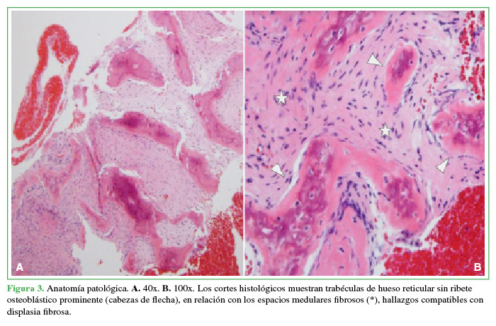 Anatomía patológica