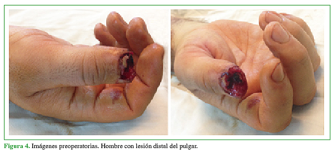 Imágenes preoperatorias