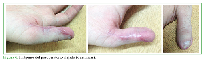 Imágenes del posoperatorio alejado (6 semanas).