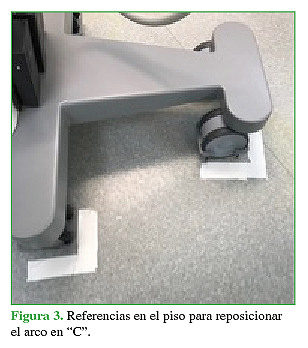 Referencias en el piso para reposicionar el arco en "C".