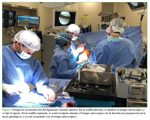 Cirugía de reconstrucción del ligamento cruzado anterior. En la rodilla derecha, se finalizó el tiempo artroscópico y se fijó el injerto. En la rodilla izquierda, se tomó el injerto durante el tiempo artroscópico de la derecha (en preparación en la mesa quirúrgica) y se está avanzando con el tiempo artroscópico. 