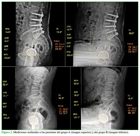 Mediciones realizadas a los pacientes del grupo A (imagen superior) y del grupo B (imagen inferior).