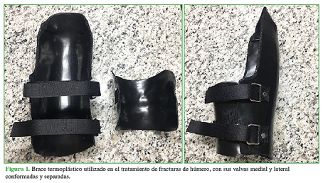 Brace termoplástico utilizado en el tratamiento de fracturas de húmero, con sus valvas medial y lateral conformadas y separadas.