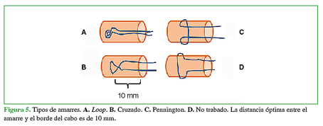 Tipos de amarres. A.Loop. B. Cruzado. C. Pennington. D. No trabado. La distancia óptima entre el amarre y el borde del cabo es de 10 mm.