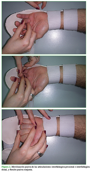 Movilización pasiva de las articulaciones interfalángica proximal e interfalángica distal, y flexión pasiva conjunta. 