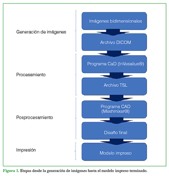 Etapas desde la generaci&oacute;n de im&aacute;genes hasta el modelo impreso terminado.