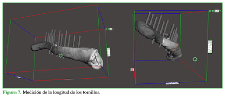 Medici&oacute;n de la longitud de los tornillos.
