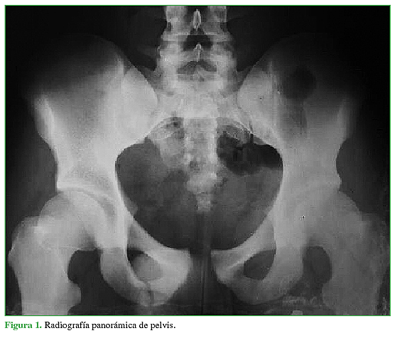 Radiografía panorámica de pelvis.