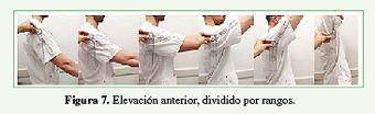 Elevación anterior, dividido por rangos.