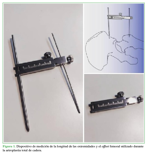 Dispositivo de medición de la longitud
de las extremidades y el offset
femoral utilizado durante la artroplastia total de cadera.