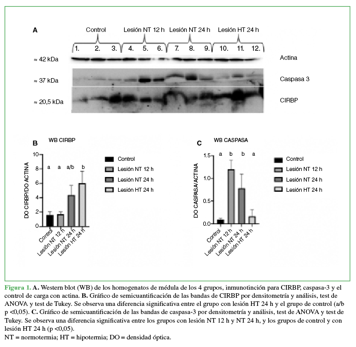 A.
Western blot (WB) de los homogenatos
de médula de los 4 grupos, inmunotinción para CIRBP,
caspasa-3 y el control de carga con actina. B. Gráfico de semicuantificación de las
bandas de CIRBP por densitometría y análisis, test de ANOVA y test de Tukey. Se
observa una diferencia significativa entre el grupo con lesión HT 24 h y el
grupo de control (a/b p <0,05). C.
Gráfico de semicuantificación de las bandas de
caspasa-3 por densitometría y análisis, test de ANOVA y test de Tukey. Se
observa una diferencia significativa entre los grupos con lesión NT 12 h y NT
24 h, y los grupos de control y con lesión HT 24 h (p <0,05). NT = normotermia; HT = hipotermia; DO = densidad óptica. 

 