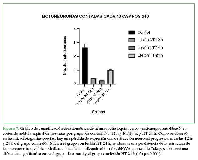 Gráfico de cuantificación densitométrica
de la inmunohistoquímica con anticuerpos anti-Neu-N
en cortes de médula espinal de tres ratas por grupo: de control, NT 12 h y NT
24 h, y HT 24 h. Como se observó en las microfotografías previas, hay una
pérdida de expresión con destrucción neuronal progresiva entre las 12 h y 24 h
del grupo con lesión NT. En el grupo con lesión HT 24 h, se observa una
persistencia de la estructura de las motoneuronas viables. Mediante el análisis
utilizando el test de ANOVA con test de Tukey, se
observó una diferencia significativa entre el grupo de control y el grupo con
lesión HT 24 h (a/b p <0,001).