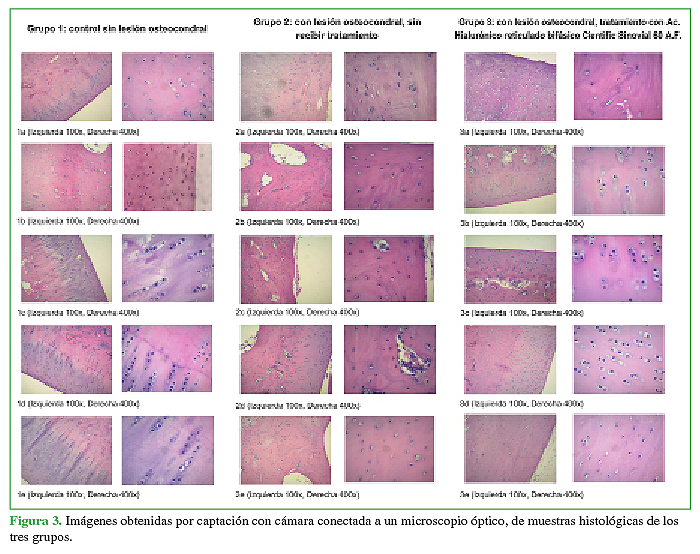 Imágenes obtenidas por captación con cámara conectada a un microscopio óptico, de muestras histológicas de los tres grupos.
