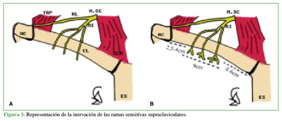 Representación de la inervación de las ramas sensitivas supraclaviculares.
