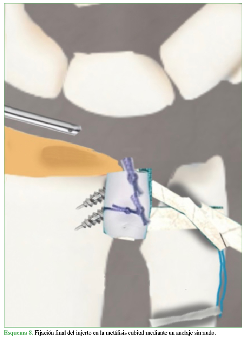 Esquema 8