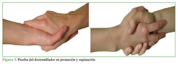 Prueba del destornillador en pronación y supinación.