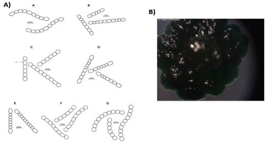 A) Diagrammatic
representation of the morphological features of isolates ascribed as Nostoc. A. Su
1. Straight and heteropolar sheathed filament with barrel-shaped cells. Basal,
intercalary and oval shaped heterocyst. B. Su 5,
straight and heteropolar sheathed filament with cylindrical cells. Single,
basal and oval heterocyst. C. Su 8, straight and
heteropolar sheathed filament with barrel-shaped cells. Spherical, basal and
intercalary heterocyst. D. Su 10, straight and heteropolar sheathed filament with cylindrical
cells. Basal, single, intercalary and oval-shaped heterocyst. E. Su 11, straight and heteropolar sheathed filament with
cylindrical cells. Basal, single and oval heterocyst. F. Su
40, straight and heteropolar sheathed filament with barreled cells. Heterocyst
were spherical, solitary and basal. G. Su 54,
straight and heteropolar sheathed filament with cylindrical cells. Heterocyst
were basal, solitary and spherical. B)
Typical colony grown in BG11o medium.