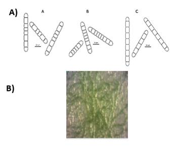 A) Diagrammatic
representation of the morphological features of isolates ascribed as Calothrix. A. Su
16, straight, heteropolar sheathed filament with conical end and cylindrical
cells. Spherical, basal and single heterocyst. B. Su
37, straight and heteropolar sheathed filament with barrel-shaped cells.
Filaments showed conical ends and, in some cases, a false branch. Heterocyst
were basal and cylindrical and flattened in one side. C. Su
45, straight, heteropolar sheathed filament with cylindrical cells and conical
end. Ovoid heterocysts were basal and solitary. B)
Typical colony grown in BG11o medium.