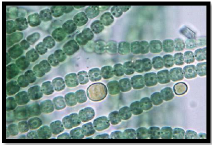 Imagen microscópica de Anabaena
azollae. Se presenta la morfología filamentosa típica y dos heterocistos