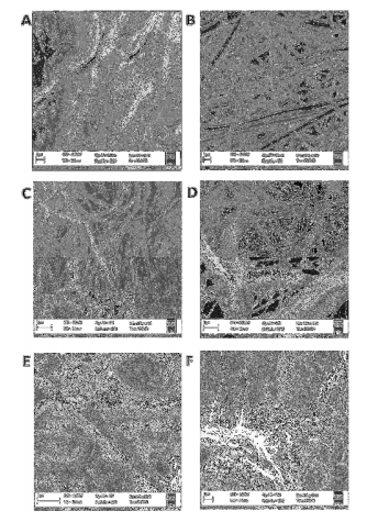 Imágenes SEM a escala de 1,0 mm.
Morfología del PVDF: (A) No modificado; (B) UTD; (C) CIFA-EST; (D) 

4.5 cm; 

(E) 8.5 cm; (F) 11.5 cm.