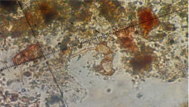 Blodgettia confervoides
