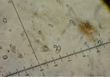 Caryosporella rhizophorae
