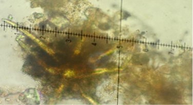 Chaetomiumsp