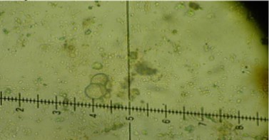 Dactylospora haliotrepha